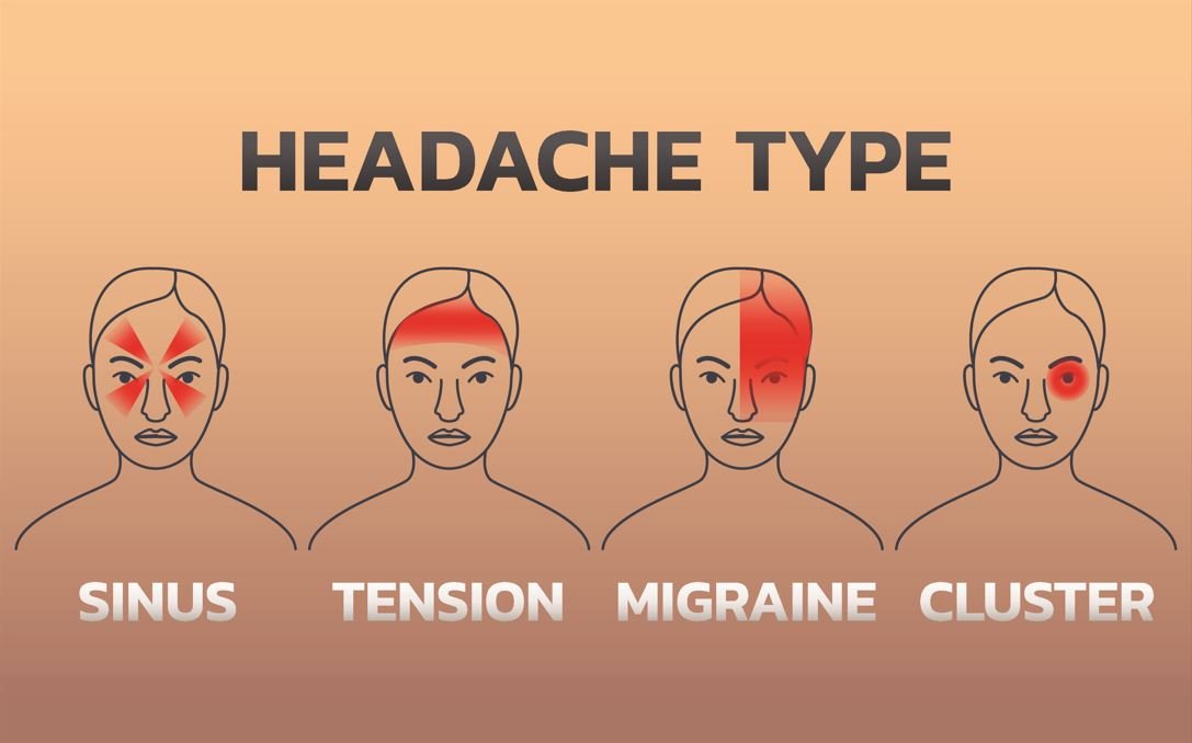 different type of headache